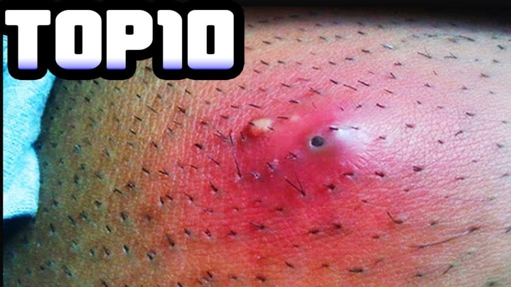 Best Pops Compilation 1