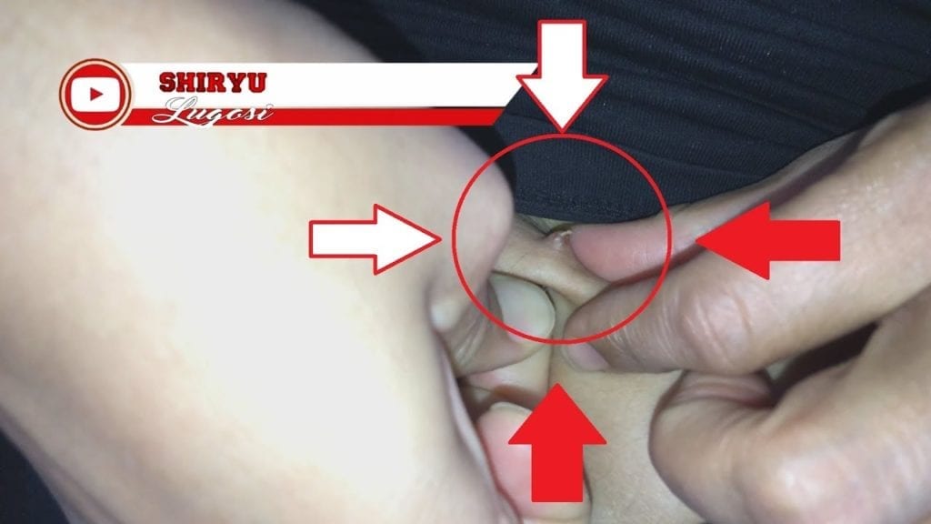 This is what happens when you don't use your #belly #button #piercing for #1year 1
