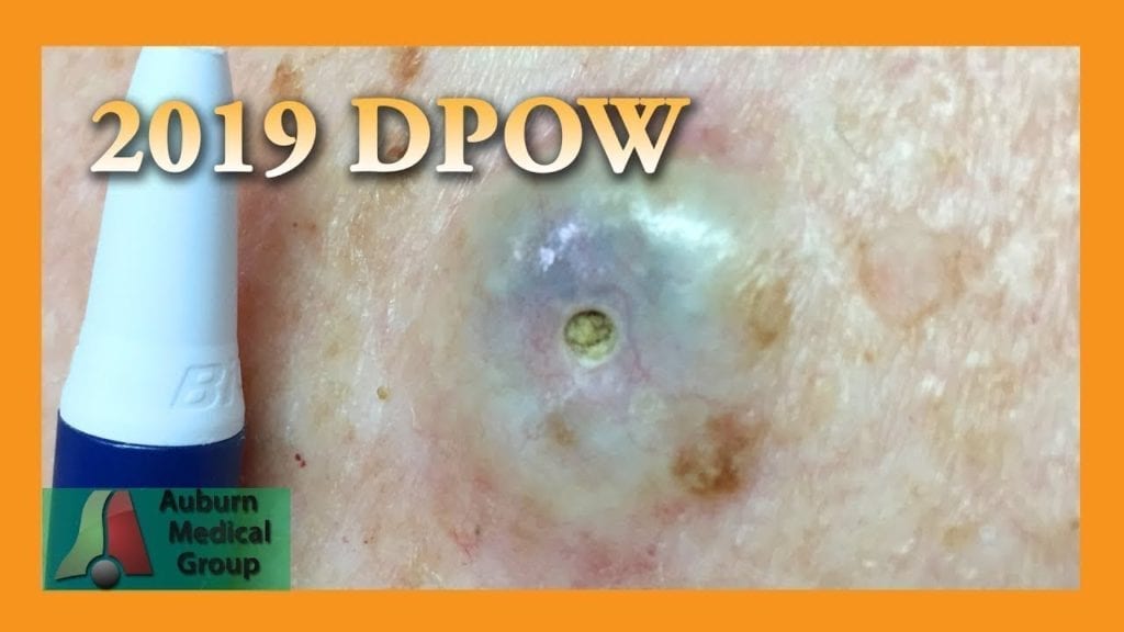 A nice dpow 1