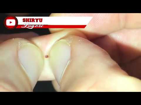 Blood Blister 4k 60FPs 1