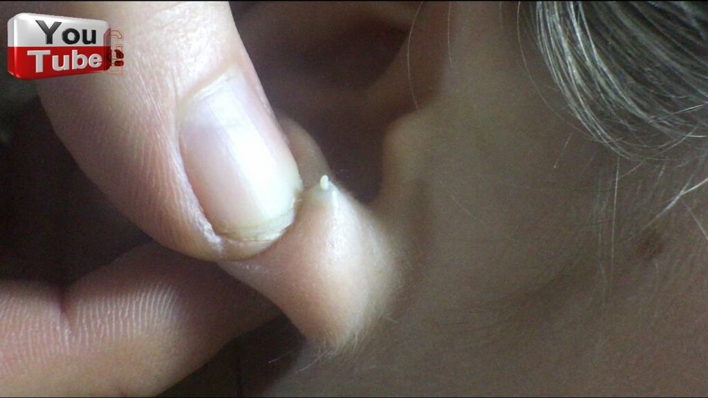 This is what happens when you stop wearing earrings 1