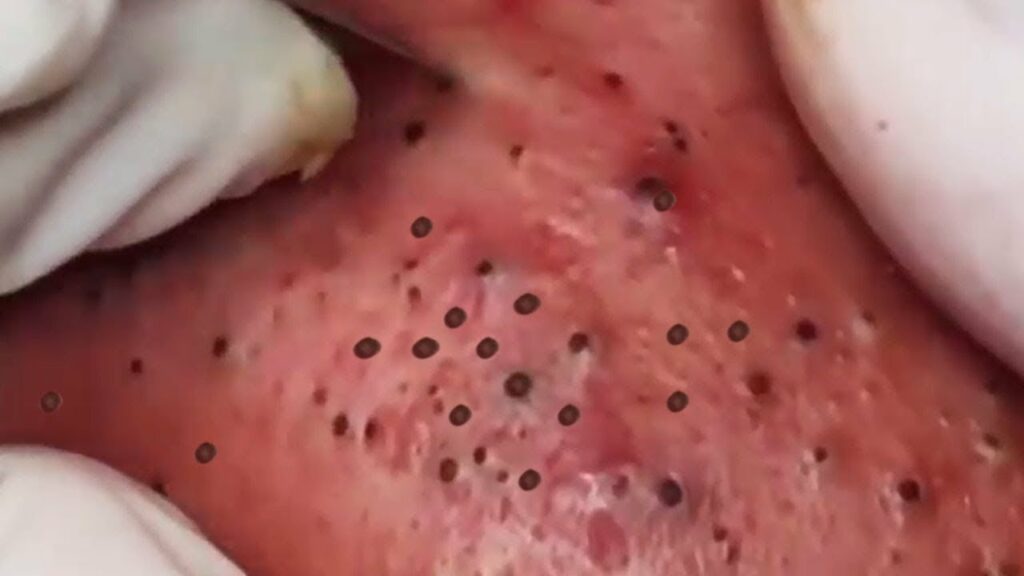 Variety of Pops 1