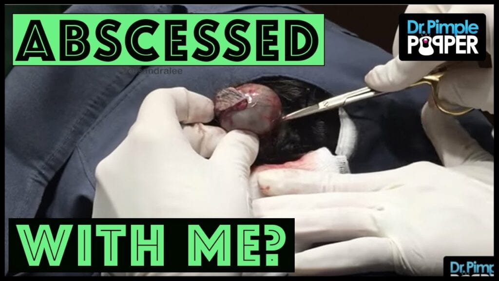 Why are you so “abscessed” with me? 1