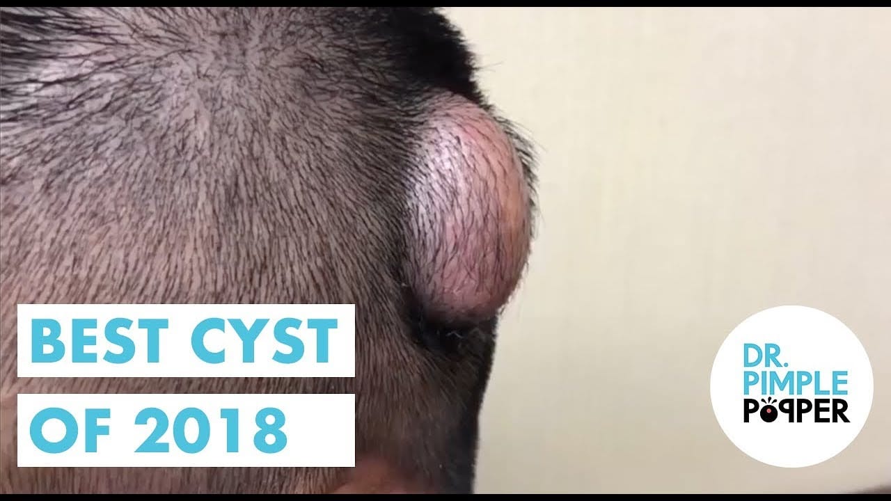 Best of Cyst Collection 1 Best of Cyst Collection 1