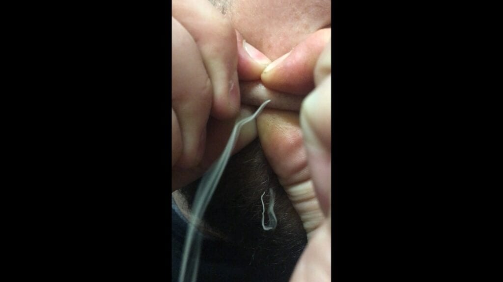 Stringy Pop 1