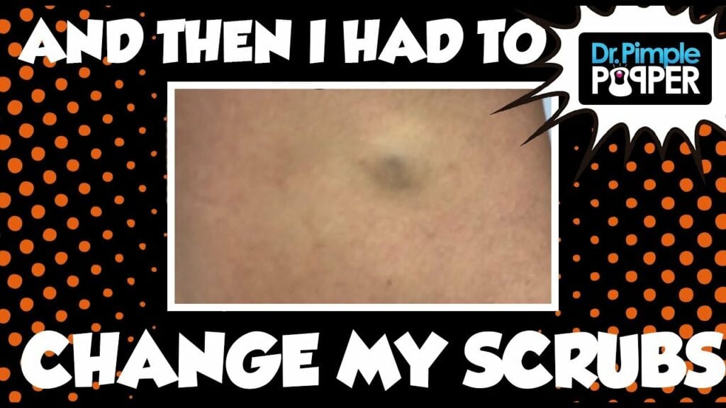 Why does Dr Pimple Popper Have to Change her Scrubs? 1