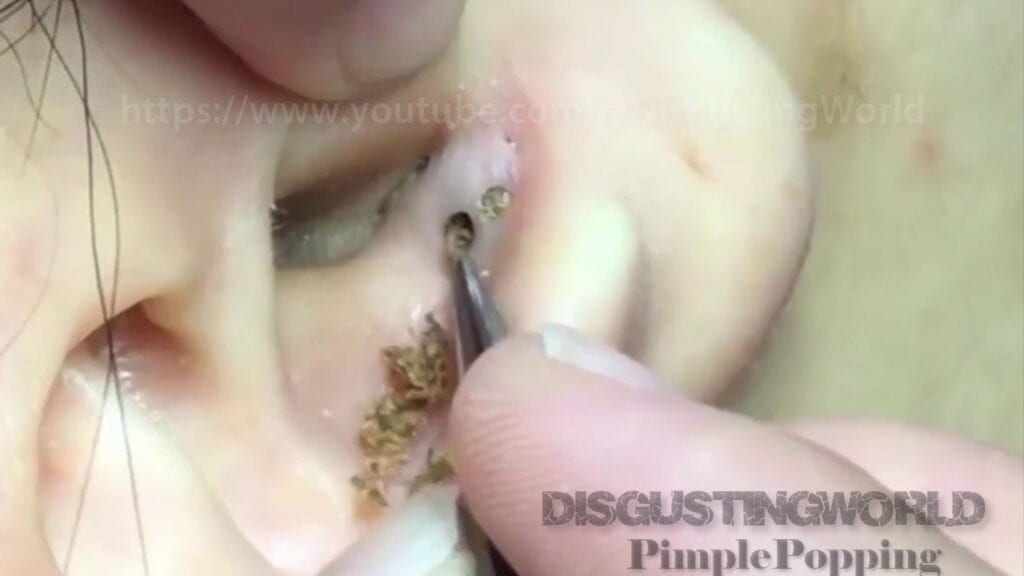 What is growing in this kid’s ear?? 2 What is growing in this kid’s ear?? 1
