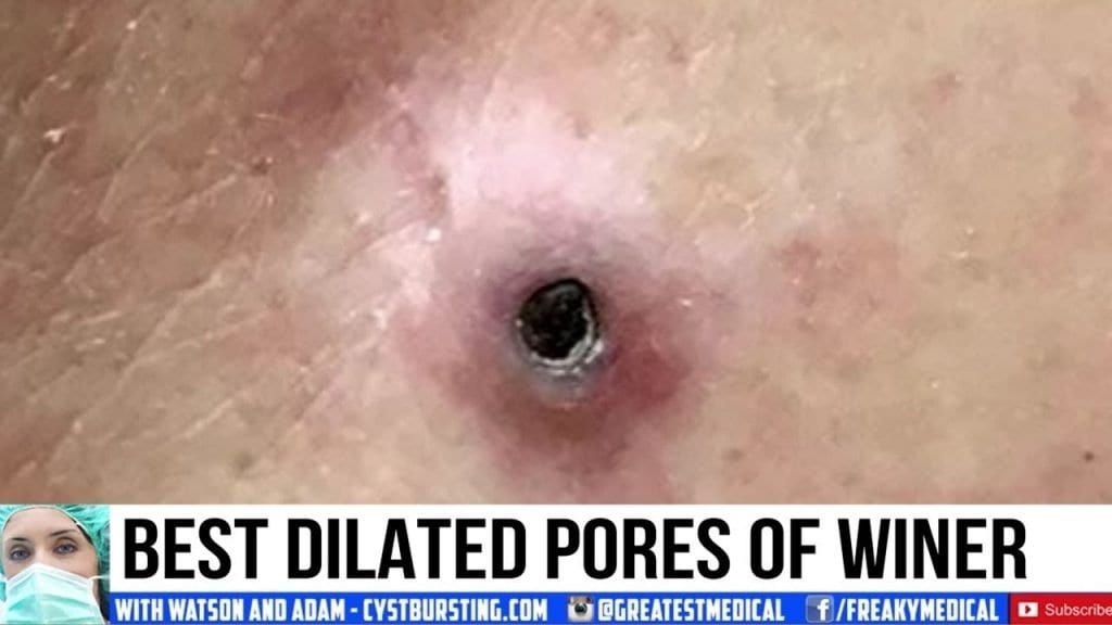 DPOW Popping 1