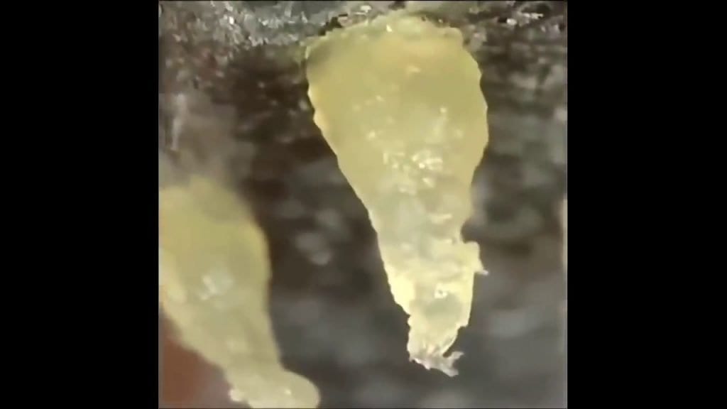 Satisfying Pimple Pop 1