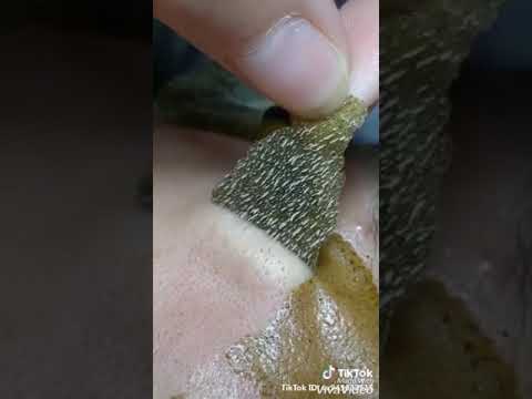 Amazing Pore Strip 1