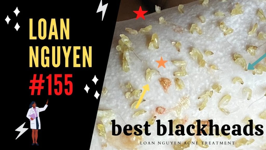We Love Loan Nguyen 1
