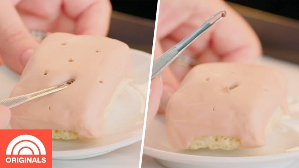 Dr. Pimple Popper: How to Remove Blackheads 2 Dr. Pimple Popper: How to Remove Blackheads 1