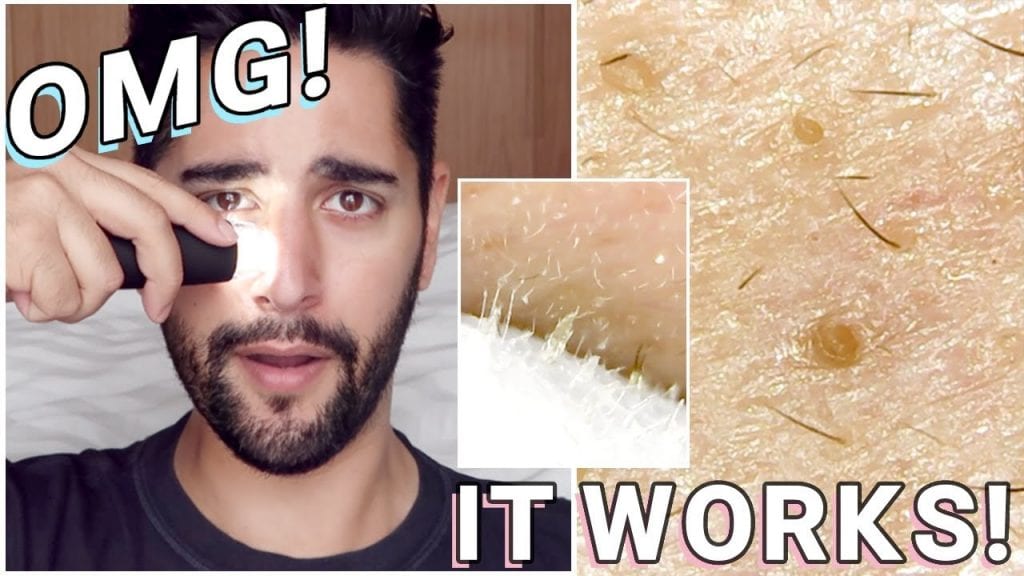 Nose Pore Strip 2 Nose Pore Strip 1