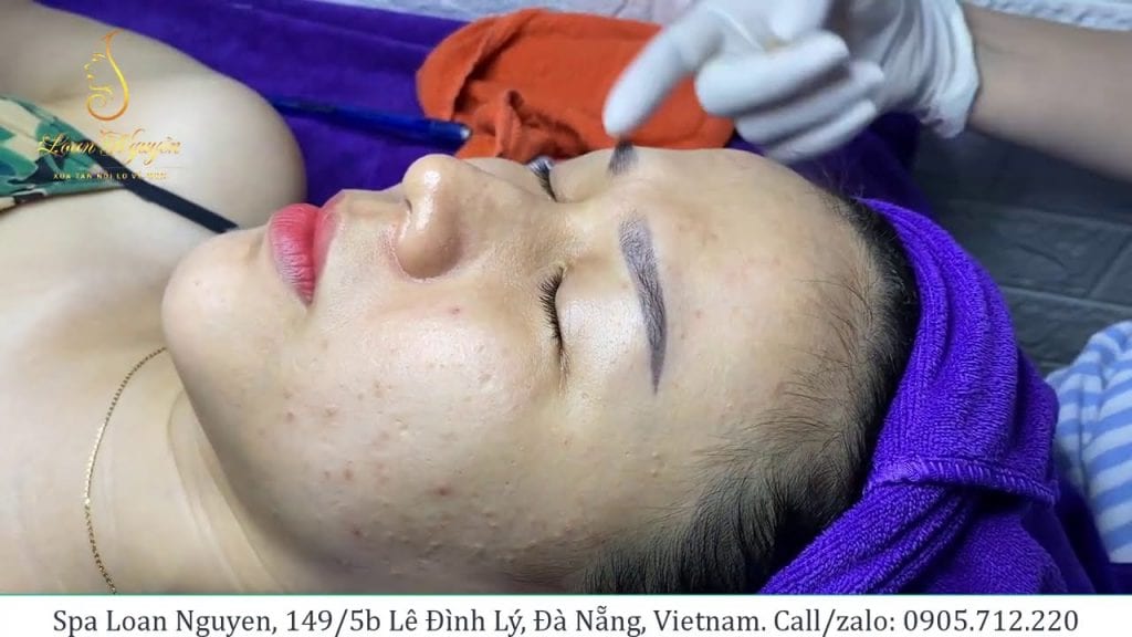 The Girl and the Blackheads 1