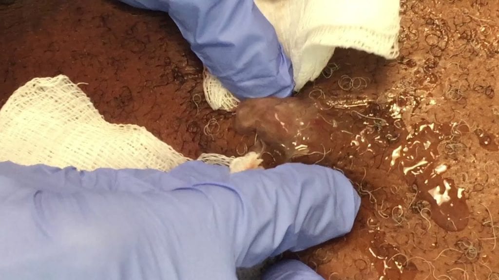 A Favorite Cyst Pop 2 A Favorite Cyst Pop 1