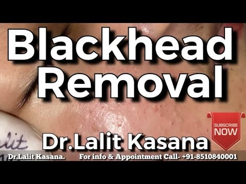 Dr. Kasana Blackheads 2 Dr. Kasana Blackheads 1