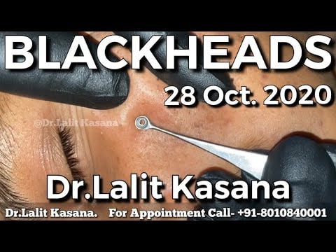 Push those blackheads out! 2 Push those blackheads out! 1