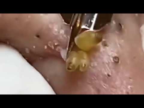 Skin Problems 1