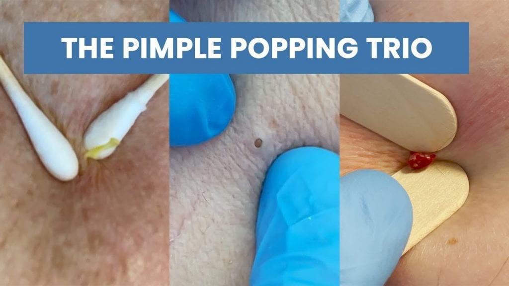 Three Little Pimples 1