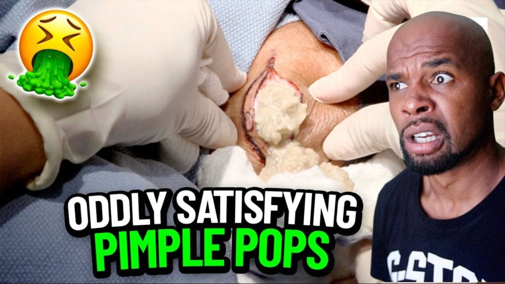 Tik Tok Pimple Reactions 2 Tik Tok Pimple Reactions 1