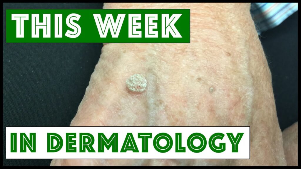 Dermatology Sampling 2 Dermatology Sampling 1