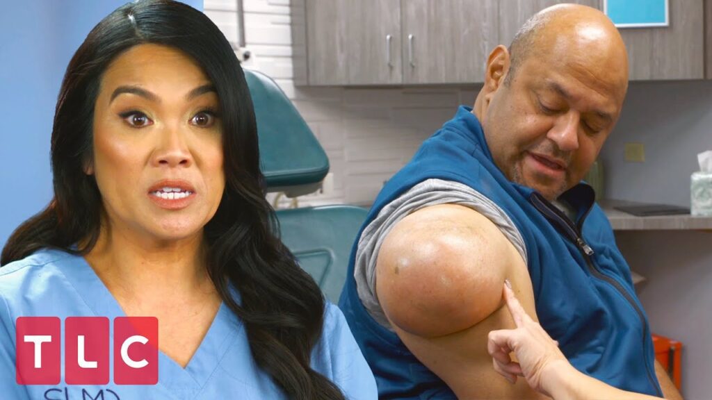 Dr Pimple Popper and the Shoulder Bump 2 Dr Pimple Popper and the Shoulder Bump 1