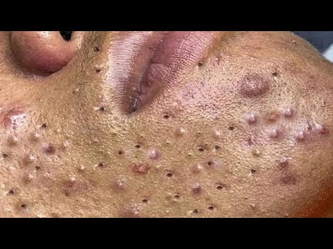 Nice Pops with Music 1