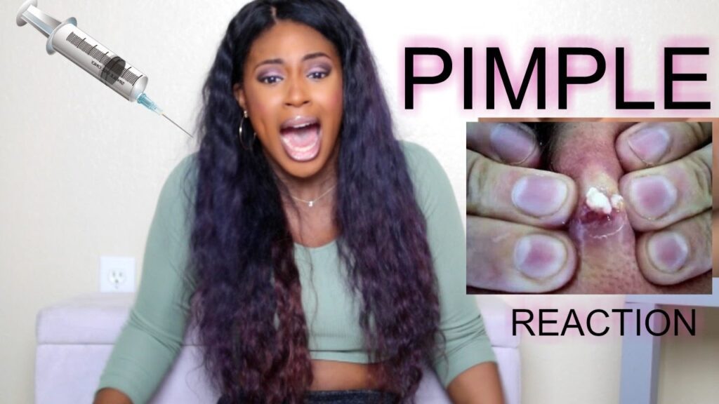 Pimple Popping Reaction 1