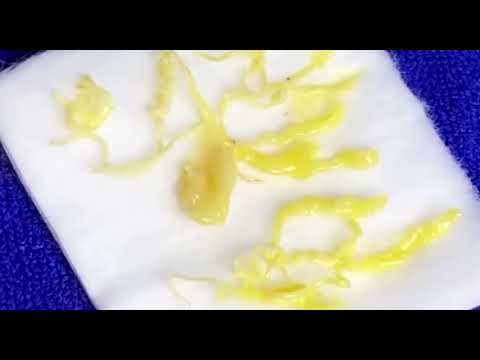 What do you call these cysts? 2 What do you call these cysts? 1