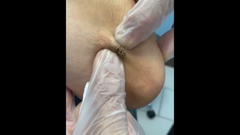 Armed with a Cyst 2 Armed with a Cyst 1