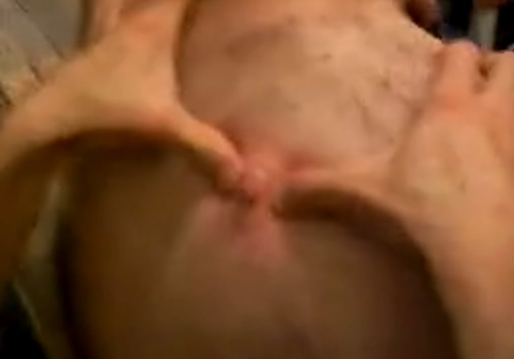 TikTok Pimple Pop 1