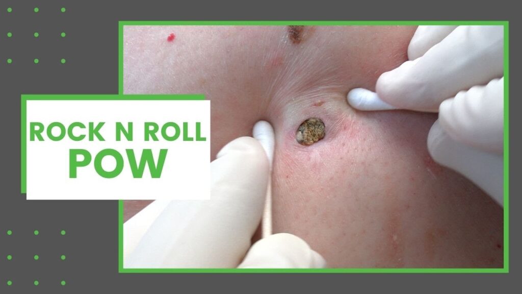 POW with Dr Derm 1