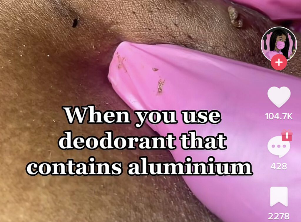 Ingrown Hair on Armpit 1