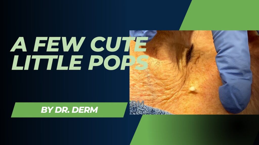 Cute Pimple Pops 1