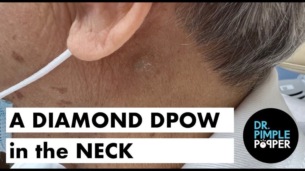 Neck DPow 1
