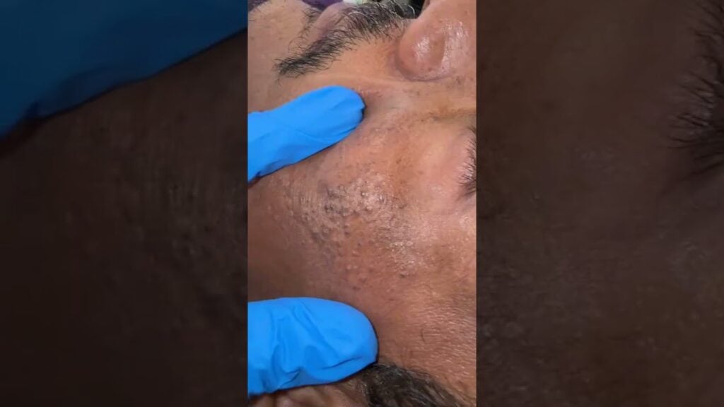 Old black head 1