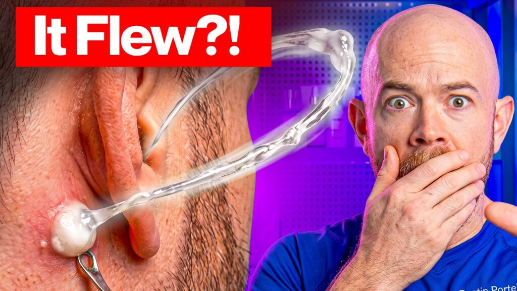Real Dermatologist Reacts to Extreme Ear, Nose, & Cyst Pops! 1
