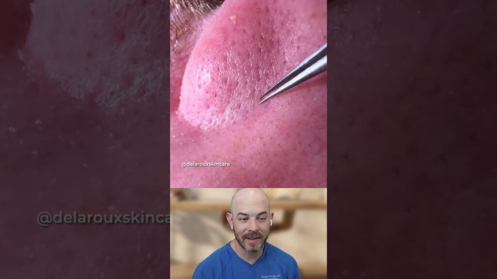 The tweezers are incredible 1
