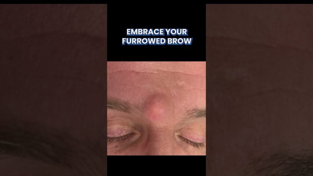 Who knew that having a furrowed brow could be an advantage??⁠⁠ 1