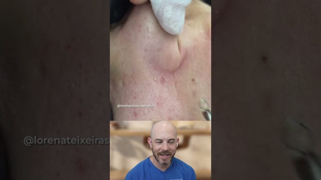 Never do this for an extraction 1