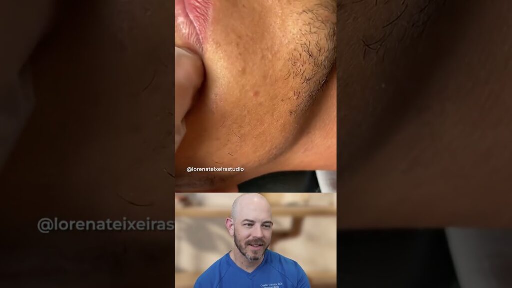 This one is going to hurt 1