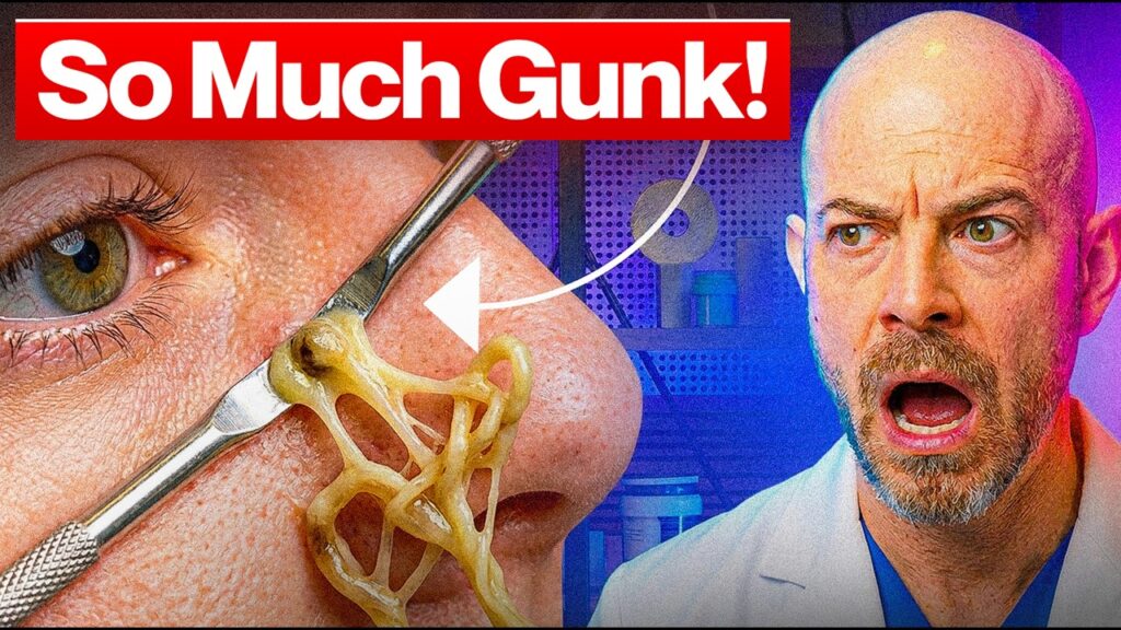 Dermatologist Reacts: The Pimple That NEVER Ends! 1