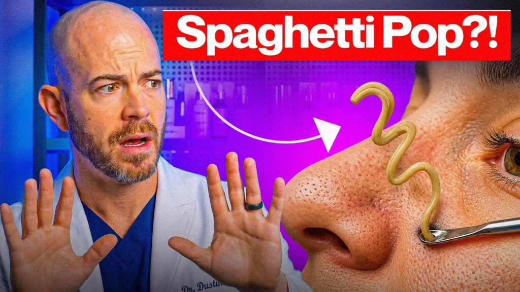 10 Minutes of INSANE Pimple Pops (Dermatologist Reacts) 1