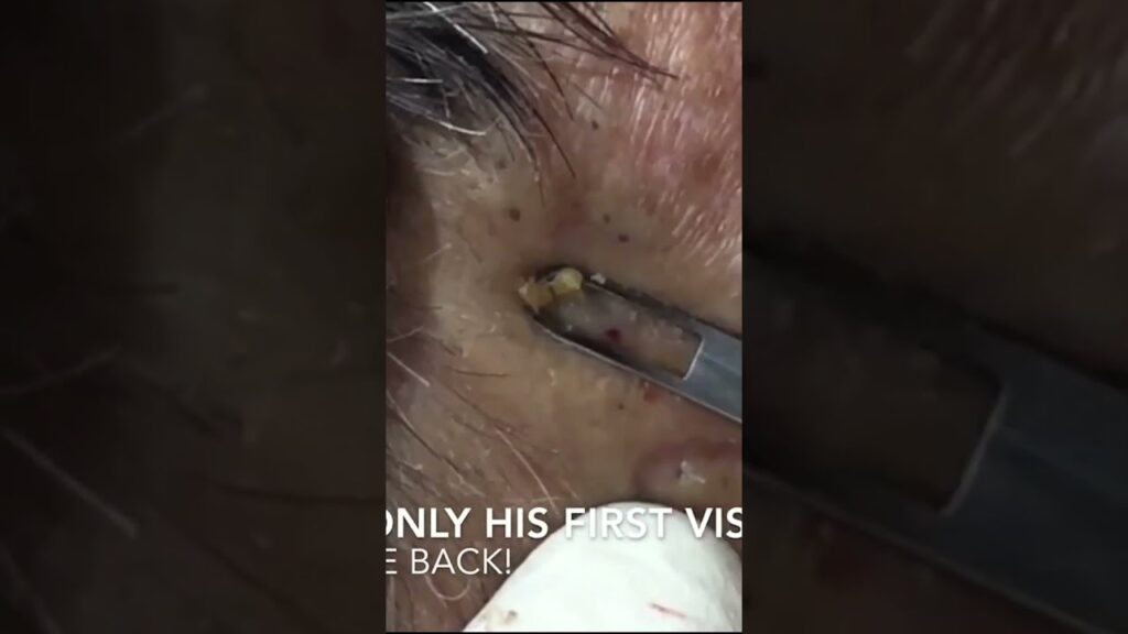 A Satisfying Extraction You Can't Miss 1